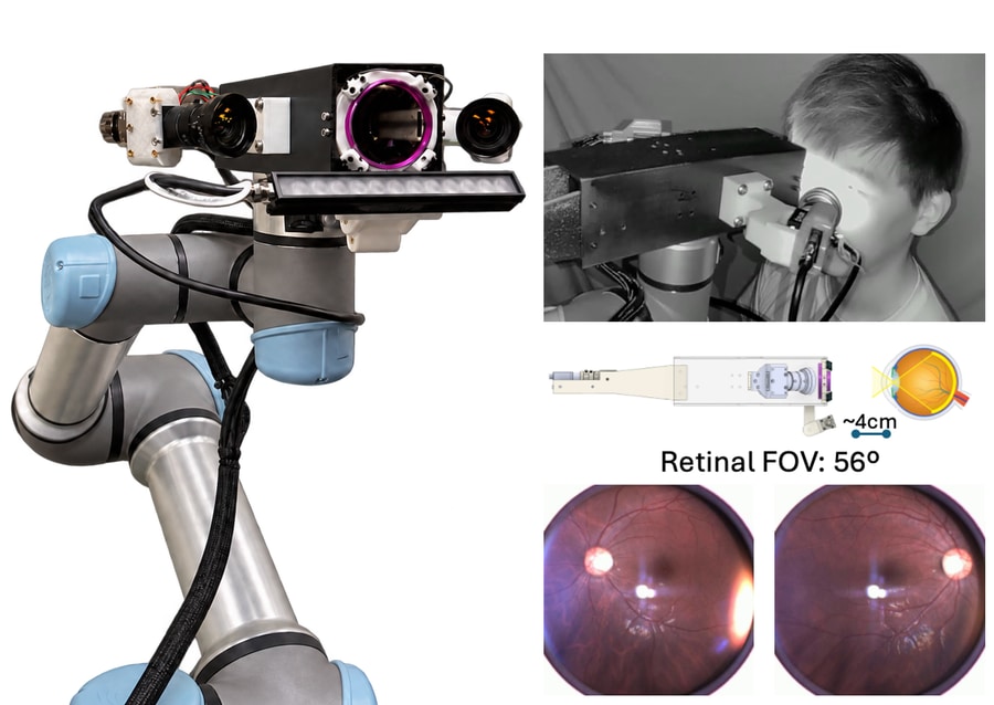 EYESIGHT robot, infrared eye examination, optical schematic, and retinal images